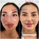 Захоронение ID 1354623